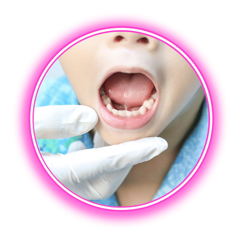 Timnath Lip and Tongue Ties